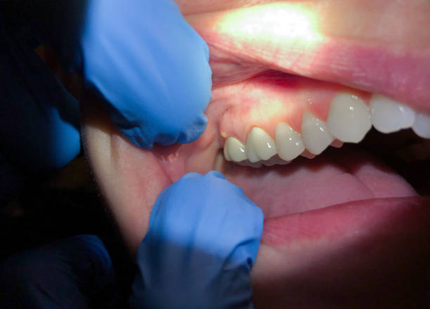 Best Broken Tooth Emergency  in Lenexa, KS
